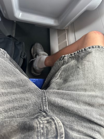 The image depicts a person's legs from the knees down, wearing grey denim shorts and white socks with grey athletic shoes. The person is seated, with a black bag visible behind their left leg and a blue object partially visible between their legs. The background suggests an indoor environment with a grey, textured surface and a white curved structure. There is a minor abrasion on the person's right knee. The scene is not located in Salses-le-Château, France.