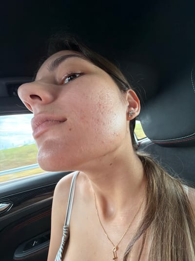 A close-up of a woman's face is presented, tilted to the left. Her facial features include an eye, nose, mouth, and ear with an earring. Her hair is brown with blonde highlights, and she is wearing a necklace. The background suggests she is inside a car, with a black leather seat and car window visible. No elements within the image suggest a location within Chokoba, Bulgaria.