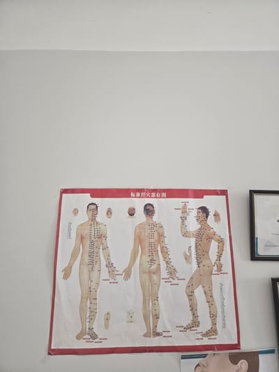 The image shows a poster of the human body with acupuncture points, mounted on a white wall. To the right of the poster, a framed document is visible. Below the poster, a part of another document with anatomical illustrations is visible. The image is taken in a room, possibly a medical office or clinic, in Gori, Georgia. There are no people visible in the image.