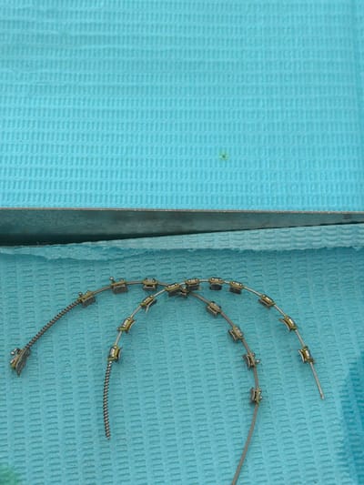 A top-down view depicts two curved sections of orthodontic archwires, each fitted with multiple metallic brackets and yellowish-green elastic ligatures, resting on a light blue, textured disposable dental bib. The bib exhibits a repeating embossed pattern. The section of the archwire on the left incorporates a small, coiled metallic spring. A metallic surface is partially visible beneath the bib along the lower edge of the frame. The scene is consistent with a clinical setting, such as a dental or orthodontic office, in Ness Ziona, Israel. No individuals are present, and no specific actions or interactions are depicted.