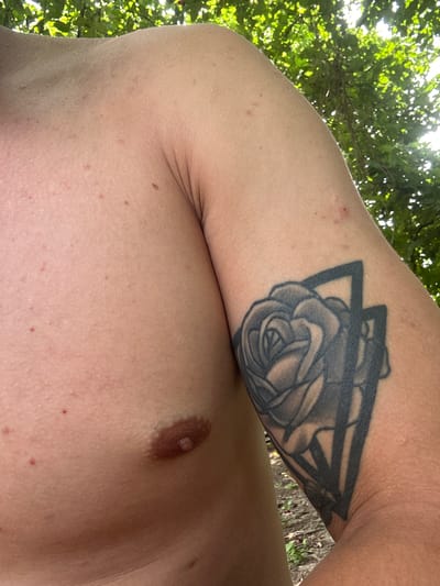 The image shows a close-up of a person's upper body, with a focus on their chest and upper arm. The person's skin is visible, with some small red bumps and moles. There is a tattoo of a rose within a geometric design on the upper arm. The background consists of green foliage and dappled sunlight, suggesting an outdoor setting. The location is identified as Velykyi Trostianets, Ukraine. There is no indication of any criminal activity or specific action.