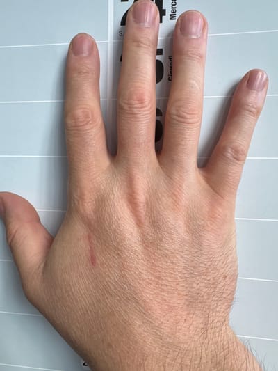 An overhead view shows a person's left hand and forearm resting on a light blue surface with thin white horizontal lines. The hand is open with the palm facing upwards and the fingers spread. The nails appear clean and unpolished. A small, reddish mark, possibly a scratch or abrasion, is visible on the lower part of the palm. The surface beneath the hand displays faint text in black, including the word "Mercedi" vertically oriented on the right side. This text suggests the surface is part of a calendar or planner. The image does not provide any information about the city of Mejaniga, Italy.