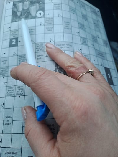 A close-up, high-angle shot captures a person's hands interacting with a Russian-language crossword puzzle in Novaya Derevnya, Russia. The right hand is prominently featured, with its index finger positioned above a clue. A gold-colored ring with a small, spherical top is present on the ring finger of the right hand, with noticeable skin irritation and dryness visible on the finger around the ring. A white pen with a blue cap is held by the partially visible left hand, pointing towards the puzzle. The crossword sheet displays various grid squares and Russian text, including a visual clue of bell peppers labeled '1' and a large number '2' for another section. The hands exhibit natural skin texture and unmanicured fingernails. The background is indistinct and out of focus.