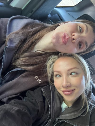 Two young women are posing close together for a selfie indoors, likely inside a vehicle. The woman on the left has brown hair, fair skin with some blemishes, and is making a puckered face. The woman on the right, leaning her head on the other woman, has blonde hair and is looking toward the left with a slight smile. Both are wearing dark-colored, zippered hoodies. The location is not evident in the image.