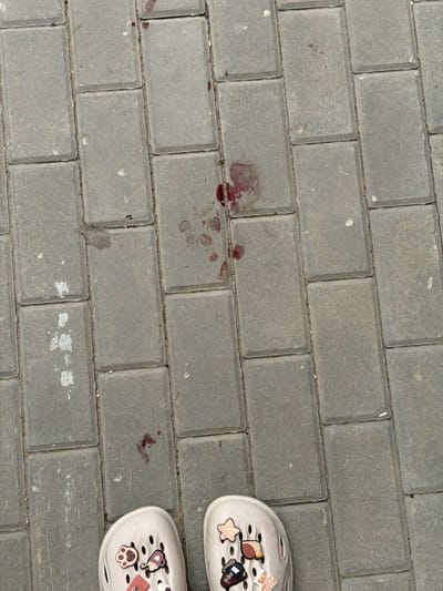 The image displays a top-down view of a paved walkway in the city of Semiluki, Russia. The walkway is constructed from rectangular grey interlocking pavers. Scattered on the pavers are several reddish-brown stains, some appearing as splatters and others as smeared marks. In the lower portion of the image, two light-colored clogs are visible, each adorned with decorative charms. One clog features charms including a paw print, a cookie, a teacup, and a squirrel. The other clog displays charms such as a starfish, a snail, a car, and a label that reads "FRUIT QUEEN". The overall environment suggests an outdoor setting on a paved surface.
