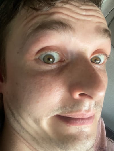 The image is a close-up, over-the-shoulder selfie of a person's face. The person has light skin, brown eyes, and short, dark, messy hair. Their forehead has prominent horizontal wrinkles. The individual's mouth is slightly open, revealing pink lips and a hint of teeth. There are some small, dark freckles scattered across their cheeks and nose. The background is blurry and appears to be a light-colored, textured surface, possibly fabric or a wall. No specific location in Brachterbeek, Netherlands, can be determined from the provided image.