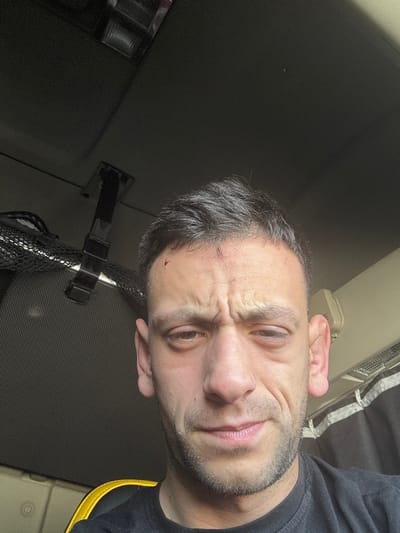 A close-up, selfie-style photograph depicts an adult male seated within what appears to be a vehicle cabin in Tortoreto, Italy. The male subject, presenting with short dark hair and facial stubble, wears a dark t-shirt. His brow is furrowed, and his eyes appear somewhat puffy. A small, fresh cut or abrasion is visible on his left forehead near the hairline, with another small red mark present further right on his forehead. The man's facial expression suggests discomfort or weariness. The immediate background features a dark overhead panel, a black mesh storage net containing an obscured item on the left, and a black strap attached overhead. To the right, a light-colored interior panel with horizontal vents is visible, along with a portion of a dark patterned curtain. A yellow and black object, possibly part of a seat or cushion, is partially visible in the lower-left foreground.