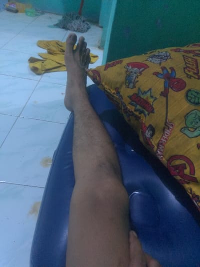The image shows a person's bare leg and foot resting on a blue, inflatable chair. The person is sitting with their leg outstretched, the foot facing the camera. The chair is partially covered by a yellow pillow with a cartoon superhero theme. The background is a tiled floor with some stains and a blue wall in the background. The image was taken indoors. The location is in Batam, Indonesia, specifically at the coordinates 1.047° N, 103.944° E. This location is near the Batam Centre area. The image was most likely taken in a home.