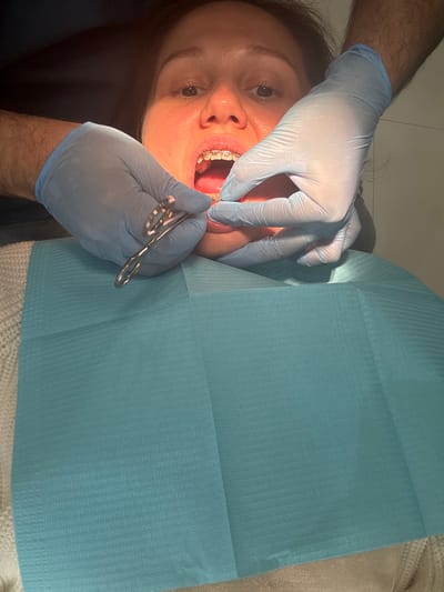 A dentist in blue gloves works on a woman's teeth, who has braces. She is lying in a dental chair and has a blue bib on. The dentist is holding scissors and using his fingers to work in the woman's mouth. The location appears to be a dental office. While it is not possible to confirm the location as Sharjah, United Arab Emirates from the image alone, if that information is accurate then the scene is occurring in a dental office in Sharjah.
