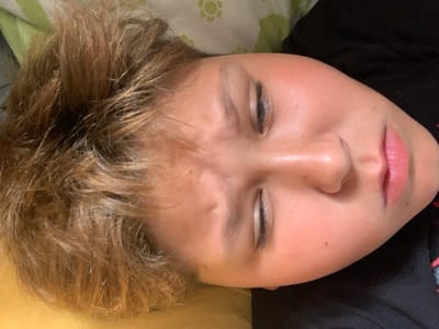 The media file shows a close-up, overhead shot of a young person lying down, with their eyes closed. Their head is tilted to the left, and their hair, which is a mix of blonde and brown, is tousled. The person is wearing a black top.
The background is blurred but appears to be a bed with a light-colored sheet and a pillow with a subtle green floral pattern. The lighting suggests an indoor setting, likely during the daytime, as there are no strong shadows indicating artificial light sources. The overall mood is one of rest or sleep.
The focus is on the person's face, highlighting their closed eyes, eyebrows, nose, and lips, which have a pinkish hue. There are no visible objects or text in the frame. The shot is taken from a high angle, looking down at the person. The location context of Vejprty, Czechia, does not provide any specific visual cues within the image itself.