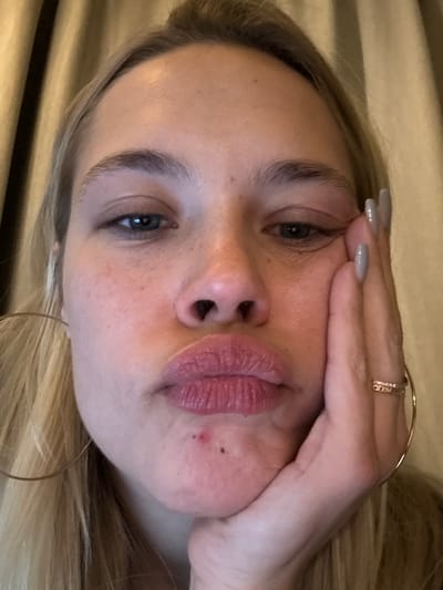 A woman's face dominates the frame. She has blonde hair, light skin, and blue eyes. Her hand is positioned near her eye, adorned with a ring and painted nails. She has a mole on her cheek, and a visible blemish near her mouth. Gold hoop earrings are also visible. The background appears to be a textured beige material.