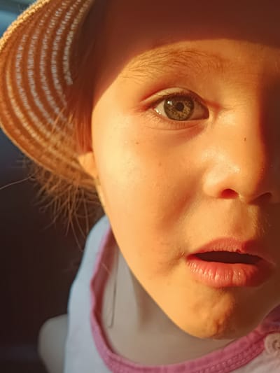 A close-up of a young girl's face, possibly between the ages of 4 and 7, wearing a straw hat. The hat casts a shadow over part of her face. She has fair skin and one eye is visible, appearing to be hazel. Her mouth is slightly open. She is wearing a white shirt with a pink trim. No information is available to place this image in Шляпники, Russia.