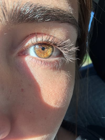 A close-up, angled view of a person's eye and surrounding skin. The eye is hazel or amber-colored, with visible eyelashes and eyebrow hairs. The skin appears light-toned, with a light shadow cast across the cheek. The surrounding environment is indistinct, but the eye reflects natural light and there's blurry background. No location context is given.
