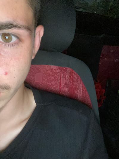 A close-up, waist-up, portrait-style photo features a person looking directly at the camera. The individual has light brown eyes, an eyebrow with dark hair, and a small mustache. There is a visible red pimple on their cheek. The person is wearing a black t-shirt. In the background, a car seat is visible, with a red fabric insert. The scene appears to be indoors, possibly inside a vehicle. The image was taken in Gorna Malina, Bulgaria.