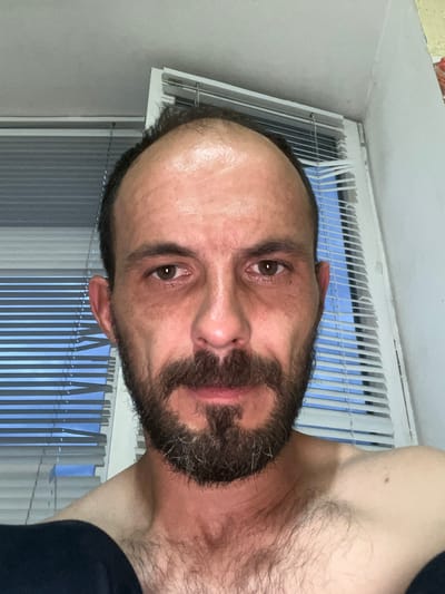 A medium shot portrait of a fair-skinned man with a beard is captured from a slightly low angle. He has short, dark brown hair, receding at the temples and across the crown, revealing a shiny forehead. His eyes are a deep brown, with visible dark circles and wrinkles beneath them. A prominent beard and mustache frame his mouth, with a hint of graying hairs. He is shirtless, with a dark garment visible on his left shoulder.

The background consists of closed white blinds with thin metal horizontal slats, behind which is a bright blue sky. The blinds are mounted on a white window frame. To the right of the window frame, a section of a white wall is visible, with a slight yellowing in the upper right corner, suggesting aging paint or wallpaper. The lighting appears to be natural, coming from the window, creating highlights on the man's forehead and casting subtle shadows. The overall environment suggests an indoor setting, possibly a room with a view of the outside. The location is identified as Shyshkove, Ukraine.