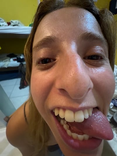 A close-up, rotated portrait shows a person sticking out their tongue. The individual has fair skin that appears oily, light brown hair, and dark eyes. The mouth is wide open, showcasing the tongue and a full set of teeth. The background includes a blurred yellow wall and some indiscernible objects, giving the impression of an indoor setting.
