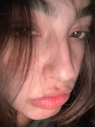 Close-up of a person's face, tilted slightly to the right, with brown hair partially obscuring the view. The person's eye is brown, their skin is light-toned, and their lips are pink and plump. The background is dark and out of focus. No indication of location in Puerto Marqués, Mexico, or further context.