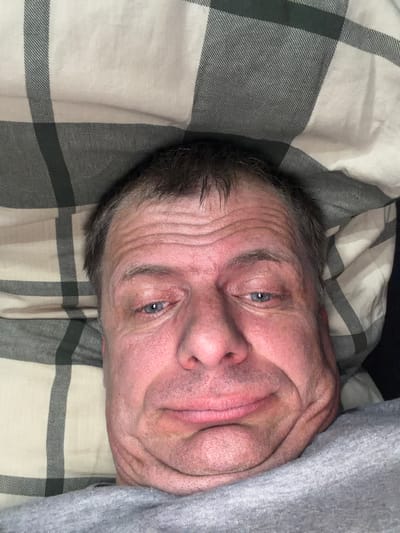 A close-up, overhead, selfie-style image shows a person's face filling the frame, partially obscured by a beige and grey plaid blanket. The person is lying down, with their head on a pillow. Their eyes are open and looking upwards. The person's skin appears flushed, and there are wrinkles on their forehead and around their eyes. The image is a very tight crop and does not provide any information about the city of New Britain, United States of America, or any specific location within it.