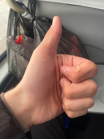 A close-up photograph depicts a person's left hand, with the fingers curled into a fist except for the extended thumb, positioned against a blurred background. The hand is pale, showing skin texture and nail detail. The wrist is partially visible, revealing a brown knitted sweater cuff. Behind the hand is a black plastic bag containing indiscernible items with a glimpse of red. The background also includes a white surface, potentially a car interior element. The setting is not identifiable as being in Karmana, Uzbekistan, based on the provided image.