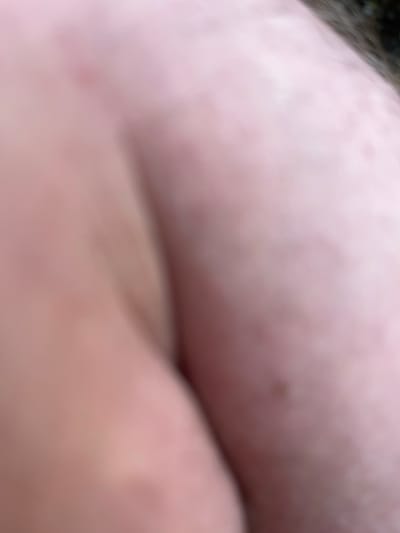 The image is a close-up, abstract shot of human skin. The focus is not sharp, creating a soft, blurred effect. The skin appears to be a light, peachy tone with some subtle variations in color and texture, possibly indicating pores or very light blemishes. In the upper left corner, there's a suggestion of a darker, rougher texture, which could be hair, fabric, or another surface. The lighting is soft and diffused, suggesting an indoor or overcast outdoor environment. No specific activity or event is identifiable due to the abstract nature of the image. The lack of distinct features makes it impossible to determine the time of day, weather, or specific emotions. There is no visible text in the image. The context of Posudov, Czechia, does not provide any visual cues to interpret within the photograph itself.