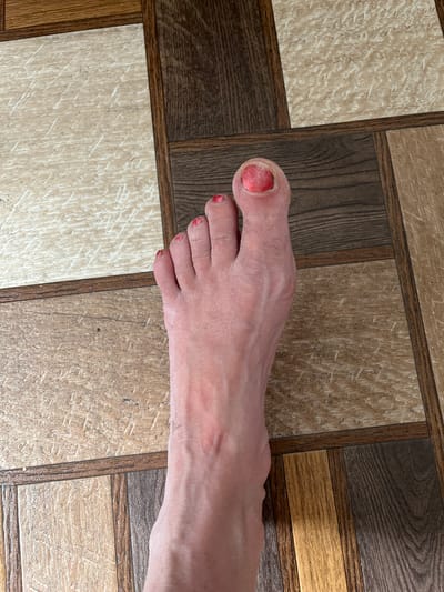 The image displays a close-up view of a person's left foot resting on a floor with a wood-grain tile pattern. The foot has painted toenails, with the big toenail appearing red and slightly damaged or inflamed. The skin on the foot exhibits some dryness and faint lines. The floor is composed of rectangular tiles in varying shades of brown and beige, arranged in a grid. There is no visible indication of the location being in Zhigalovo, Russia.