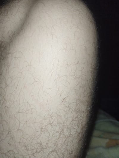 The image is a close-up, high-angle shot of human skin, likely an arm or leg, with visible hair follicles and fine hairs. The skin is pale with some areas of light pinkish hue, possibly indicating minor irritation or blood vessels close to the surface. The lighting is dim, creating a dark shadow on the right side of the frame, obscuring details of the environment. No specific location in Ciuciulea, Moldova can be determined from this image alone. The scene is static and focuses solely on the texture and surface of the skin.