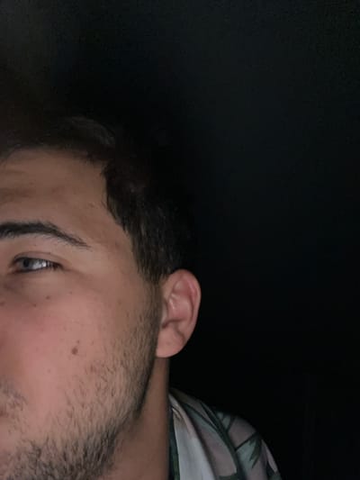 A close-up, outdoor, waist-up shot shows the left side of a person's face and ear against a dark background. The person's eye is open, with dark eyebrows and visible stubble on their cheek. They are wearing a patterned shirt with green, white, and pink elements. The image's lighting suggests it was taken at night. There is no discernible city, street, or any specific geographical markers visible in the image.