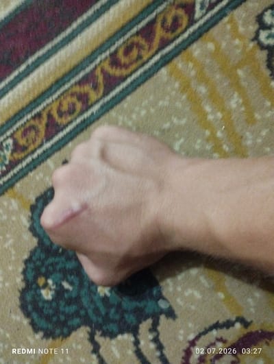The image shows a close-up of a person's left hand, which has a visible scar on the back of the hand, near the knuckles. The hand is resting on a patterned carpet. The carpet has stripes of maroon, yellow, and green, with a repeating pattern of dark green shapes. The background is out of focus, but appears to be the same carpet. The image also has overlaid text indicating "REDMI NOTE 11" and a date and time: "02.07.2026 03:27". The scene does not provide enough information to determine the location within the city of Türkmenabat, Turkmenistan.