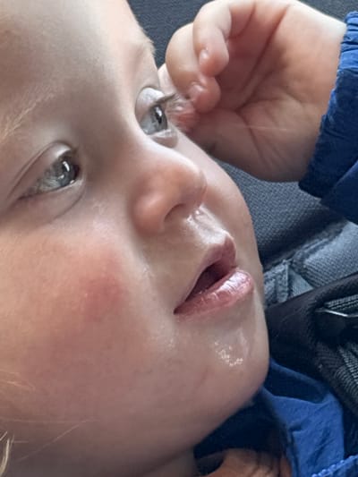 A close-up, low-angle shot focuses on a young child's face. The child is lying down, looking upwards and slightly to the left. The child's mouth is slightly open, with light reflecting off the lips. The skin is fair, with a rosy cheek. A hand with small fingers is positioned near the child's left eye, possibly touching the eyelid. The child's eyes are light-colored and directed upwards. Parts of a blue garment are visible in the upper left and upper right of the frame. A textured gray surface, possibly fabric, is also visible in the upper left background. The photo does not contain enough information to provide location information.