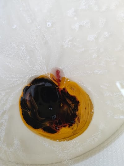 The image displays an overhead, close-up view of a circular, light off-white basin containing a mixture of viscous liquids. A prominent irregular mass of dark brown-black liquid, exhibiting swirling patterns and containing several small, dark, roughly spherical inclusions, occupies the central area. This dark liquid is intermingled with and partially encircled by a vibrant yellow-orange liquid, also displaying internal swirls. A translucent, pale pink-red amorphous blob protrudes from the superior edge of the combined liquids. The surrounding light-colored basin surface features numerous small, white, granular patterns consistent with splashes or dried residue, radiating outwards from the central liquid area. A curved segment of the basin's rim is visible in the lower right quadrant, indicating the container's structure. No individuals are present, and no active processes are depicted beyond the static arrangement of the liquids and residue. The specified location for this scene is the Municipal Unit of Acharnes, Greece.