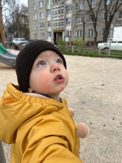 A close-up shot of a baby wearing a brown knit hat and a yellow jacket. The jacket has small, tan pom-poms. The baby has fair skin, blue eyes, and a slightly open mouth revealing some teeth. The background shows an apartment building and a playground slide. The baby appears to be outdoors on a concrete surface. The image seems to be rotated to the side.