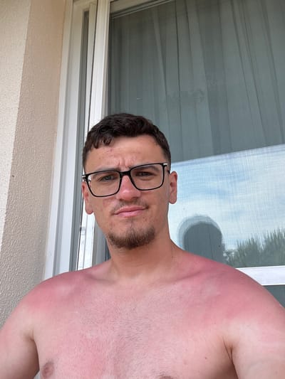 A close-up, rotated portrait shows a man with dark hair, a beard, and black-framed glasses, looking directly at the camera. He appears to be shirtless. A significant and visible sunburn covers his shoulders and upper chest, marked by distinct red areas contrasting with lighter, unburnt skin, indicating where clothing once provided coverage. His expression is neutral, with some wrinkles visible on his forehead.
The man is positioned indoors, in front of a screened window or sliding glass door. The screen's mesh pattern is clearly visible, obscuring the view beyond it but suggesting a bright daytime outdoor scene with hints of blue sky and perhaps some foliage or distant structures. A soft, circular shadow is cast on the screen in the upper right. Below the window, a textured, light-colored wall, possibly stucco, is visible. The overall lighting suggests it is daytime, and the sunburn strongly implies a recent exposure to sunny weather. The location context provided is Selçuk, Turkey. There is no visible text in the image.