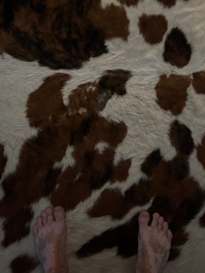 The scene is an interior view within Miami Shores, United States of America. The floor is covered by a patterned rug or mat, exhibiting a cowhide-like design composed of irregular dark brown and off-white/cream colored sections of short-pile texture. Two bare human feet are centrally positioned at the bottom of the frame, resting on this surface. Both feet display patches of hypopigmentation, appearing as distinct, irregularly shaped white or pale areas against a lighter, natural skin tone. The feet are static, viewed from a top-down perspective, suggesting a standing posture. No other individuals or significant objects are visible.