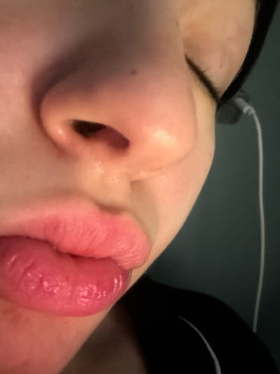 The image presents a close-up, cropped view of the right side of a human face, specifically focusing on the nose, mouth, and a portion of the right cheek and ear. The subject exhibits light-toned skin, with full, reddish-pink lips appearing moisturized. The nose shows a visible nostril opening and a small dark mark on the bridge. Dark hair is visible near the upper right, and a white earbud with a thin white wire is present, indicating it is inserted into the right ear canal. The background is a uniformly dark teal color, suggesting an indoor setting with an unidentifiable plain surface. No specific actions beyond wearing the earbud are discernible. This scene is located in the city of Arthès, France.