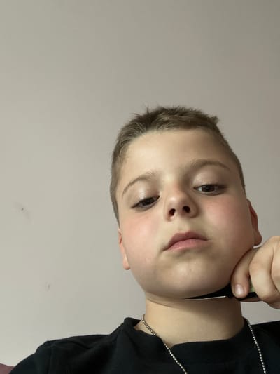A close-up, slightly angled shot of a person with fair skin, light brown hair, and visible eyes, nose, and lips. The person is holding a black object near their face, possibly a pen or similar instrument. A black shirt or garment is visible on the right side of the image, and a silver chain is near the neck. The background is a plain light grey or white. There is no indication of location, city, or environment, and no interaction visible beyond the person holding an object near their face.