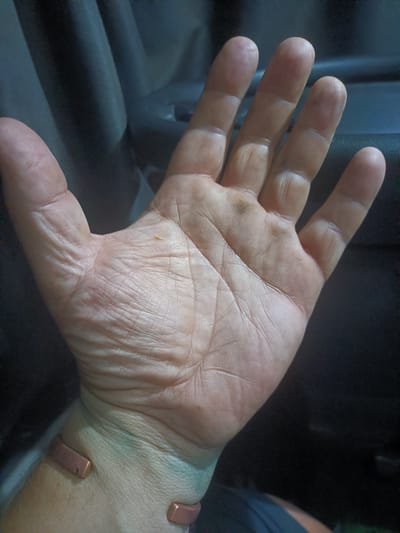 The image shows a close-up view of a person's right hand and wrist. The hand is open, palm facing upwards, revealing lines and textures on the skin. Several fingers are visible, with distinct fingerprints. A small, light-colored speck is present on the palm. The wrist is adorned with a copper bracelet. The background appears to be an interior environment, possibly a vehicle cabin, with dark, textured surfaces. There is no indication of the city of Bagno di Romagna, Italy, in the image.