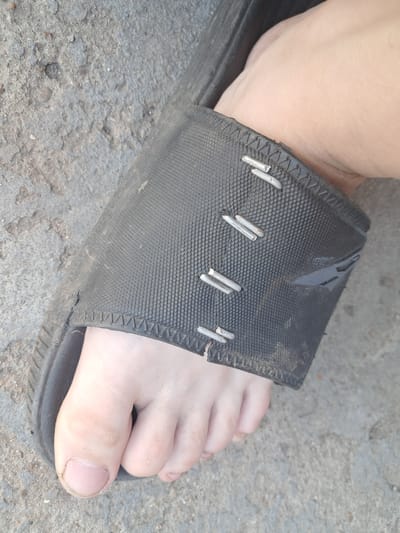 A close-up, high-angle shot shows a person's bare foot wearing a black sandal. The sandal's strap is textured and secured with multiple metal staples. The foot is positioned on a rough, gray, concrete-like surface. The image is undated and unlocated.