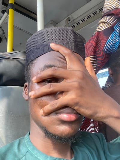 The image depicts a close-up, indoor scene within a public transport vehicle, likely a bus, located in Ebute-Metta, Nigeria.
The primary subject is a male individual, appearing to be in his twenties or thirties, with dark skin, a faint beard, and short dark hair. He wears a dark green short-sleeved shirt and a dark grey or black perforated kufi cap. His right hand is raised, with fingers spread, covering the majority of his face from the forehead to the upper lip, partially obscuring his right eye while his left eye is visible. His lips are slightly parted.
In the background to the left, a black bag rests on a light-colored seat or overhead rack. Above it, a yellow vertical support pole and a white horizontal overhead pole are visible, consistent with a vehicle interior. To the right background, a patterned fabric with red, blue, white, and black geometric designs, possibly traditional African print, hangs or covers a seat. Partially visible behind this fabric is the dark-skinned shoulder and head of another passenger. A light-colored screen or window is also visible in the upper right, with faint text including the words "Cash" and "police case" partially discernable. The lighting suggests ambient daylight.