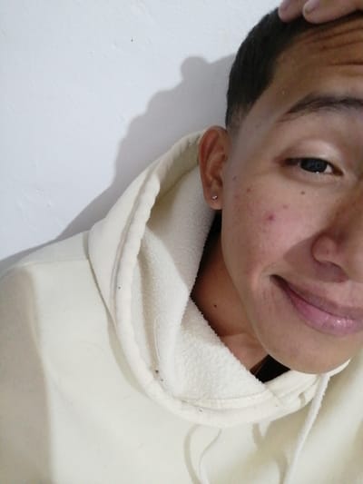 A person in a cream-colored hoodie poses closely to the camera. The person has short, dark hair and is touching their head with their hand. A small earring is visible in their left ear. Their face has a few minor blemishes. The background is a plain white wall with a shadow. The person is smiling slightly, and their face takes up the majority of the frame.