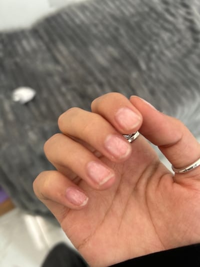 A close-up image of a human hand with short, unpolished fingernails. The hand is adorned with two silver rings, one on the ring finger and one on the thumb. The skin is fair-toned with visible creases and lines. The background appears to be a blurred gray and white surface. The location is not discernible.