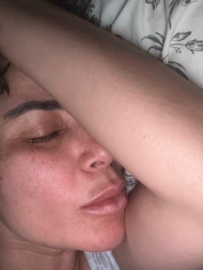 A close-up, overhead shot shows a person's face partially covered by their arm. The person's eyes are closed, and their lips are slightly parted. Their skin is flushed, with some visible pores and freckles. The arm covering the face appears to be smooth and unblemished. The background consists of a floral patterned sheet. The image appears to be taken in a bedroom in Bellmore, United States of America.