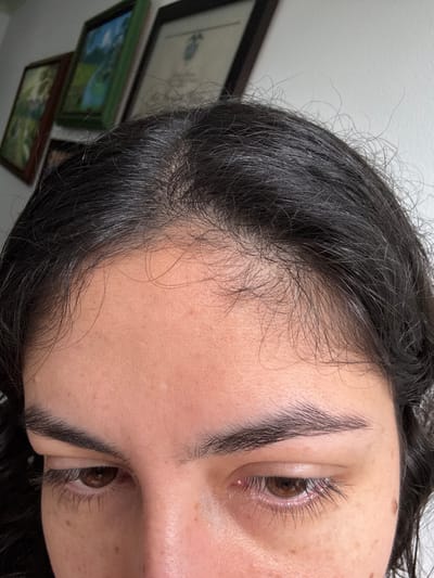 The image displays the upper facial region of an individual in an indoor setting within AMCO, Area Metropolitana Centro Occidente, Colombia. The subject exhibits dark, straight hair, parted centrally, with fine, loose strands visible along the hairline and forehead. The skin tone is light to medium, featuring scattered freckles or small moles across the forehead and periorbital areas. Dark brown eyes are directed downwards. Eyebrows are dark and appear full and well-defined. The background consists of a plain white wall upon which three framed items are mounted. From left to right, these include a dark-framed image, a green-framed image containing a landscape, and a dark-framed document, possibly a certificate, displaying text and a crest. No other individuals, objects, or actions are discernible within the frame. The lighting suggests an ambient, possibly natural, source.
