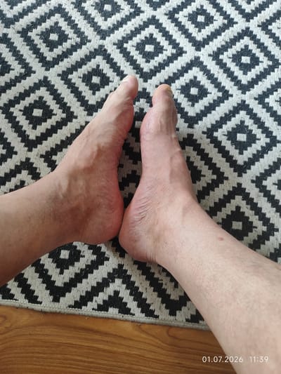 This media file shows a close-up view of two bare feet resting on a patterned rug. The rug has a geometric design with alternating black and white diamond shapes. The feet are positioned side-by-side, with the soles facing downwards. The skin tone of the feet suggests they belong to a person with fair to medium complexion. The left foot appears slightly more prominent, with visible veins on the top. The toes of both feet are visible, with one toenail on the left foot appearing slightly lighter than the other. The right foot is positioned slightly behind the left and is partially obscured. The background consists of the rug, and a wooden floor is visible at the bottom edge of the frame. The lighting suggests it is daytime. In the bottom right corner of the image, there is visible text that reads "01.07.2026 11:39", indicating the date and time the photo was taken. The overall scene is simple and focuses on the feet and the rug. There are no overt signs of specific activity or emotion. The location context provided is Lębork, Poland.