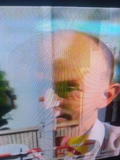 The image presents a pixelated, screen-captured scene, affected by a distinct vertical color shift where the left portion exhibits a bluish-white tone and the right a warm, yellowish-orange hue. The primary subject, an individual, is positioned on the right side of the frame. This person has a light skin tone and appears to have a shaved head or very short hair. Dark obscuration, possibly sunglasses, covers the eye area, from which a thin, bright vertical line descends. The mouth is open, and a white object, consistent with a cigarette or pen, is held between the fingers near the mouth. The individual wears a light-colored, collared shirt, likely white, with a darker element visible below the collar. A yellow and red object is partially visible below the chin. The background is heavily blurred and indistinct. On the far left, dark green shapes suggest foliage. Below the subject, a light-colored structure resembling a railing or balustrade, composed of vertical slats and a horizontal top rail, is present. The specific location in the city of Mista Ali, Nigeria, cannot be determined from the visual information provided.