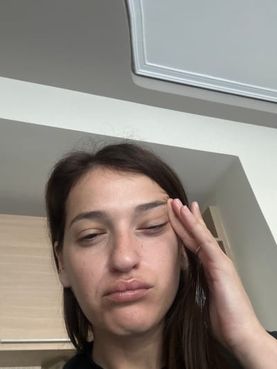 A female individual is depicted in a medium-close-up, angled slightly upwards, within an indoor setting in the Kalyvia Thorikou Municipal Unit, Greece. She possesses dark brown hair, a fair complexion with visible freckles across her nose and cheeks, and her lips appear full and slightly glossy. Her left eye is closed, her right eye is partially closed, and her mouth is downturned with lips pressed together. Her left hand is raised, with fingers splayed, and the palm is pressed against her left temple. A thin, gold-colored ring is present on her left ring finger, and a small gold-colored hoop earring is visible in her left earlobe. In the background to the left, a section of light-colored wooden cabinetry with a horizontal metallic handle is visible. Above and behind the individual, a plain white wall transitions to a white ceiling featuring decorative molded trim. The lighting is even and diffused.