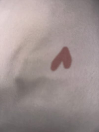The scene is located in Easingwold, United Kingdom. The image displays a close-up, blurred view of a light-colored, off-white surface, consistent with textile material. A prominent, irregular, reddish-brown mark, approximately 2.5 cm wide, is situated slightly above the center-right. This mark presents as a bifurcated shape, resembling an inverted 'V' or two contiguous lobes, with diffuse, softened edges. A fainter, amorphous shadow or discoloration is visible in the lower-left quadrant of the frame. No individuals, distinct man-made objects, actions, or specific environmental features are discernible.