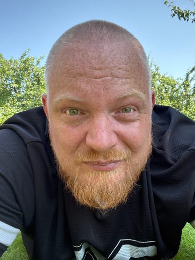 A man with a shaved head and a ginger beard is looking directly at the camera. He is wearing a black shirt with white accents on the sleeves. The background shows green trees and a clear blue sky. The man appears to be outdoors, possibly in a grassy area. The image is a close-up selfie.