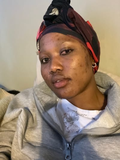 The media file shows a close-up, tilted shot of a person wearing a grey hooded sweatshirt over a white t-shirt. The person is also wearing a headscarf with a pattern of red, black, and white. They have several facial piercings: a hoop in their left ear, a ring in their nose, and a smaller hoop below their lower lip. The person's skin has some texture and appears to have blemishes. Their eyes are open, and their mouth is slightly parted, with their tongue visible. The overall lighting suggests an indoor setting, possibly during the day. There is no visible text in the image. The location context provided is Randburg, South Africa, but there are no specific visual cues in the image to confirm this. The person's expression could be interpreted as relaxed or perhaps a bit tired. The t-shirt has a faint, grey graphic print, but it is not clearly discernible.