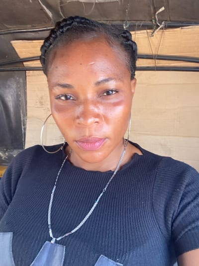 A chest-up portrait of an adult female, presumably in Odo Ona, Nigeria. The subject has dark skin and her hair is styled in dark, tight braids pulled away from her face, exposing her forehead. She looks directly forward with a neutral expression. A faint horizontal mark is visible on her forehead, and there are areas of subtle discoloration or shadow present on her upper cheeks and beneath her eyes. She wears large, circular, silver-colored hoop earrings and a long, slender silver-colored chain necklace with a small, faceted pendant resting on her chest. Her attire consists of a black, ribbed short-sleeved top. A segment of grey fabric or design is visible at the lower left of the frame, possibly part of her clothing. The background comprises a light brown, horizontally paneled or corrugated surface, along with dark, tubular or bar-like structural elements. Thin wires or cords are visible in the upper background.