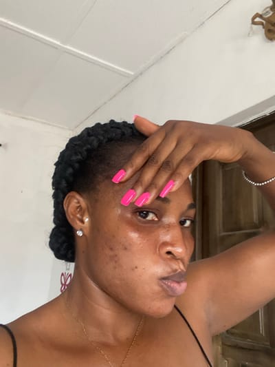 An adult female, identified as being in Odo Ona, Nigeria, is depicted in a close-up, chest-up shot. She has dark skin with visible acne or blemishes on her cheeks and forehead. Her dark hair is styled in braids, pulled back from her face. She is wearing a black spaghetti-strap top, a thin gold chain necklace, and small clear stud earrings in both ears. Her left hand (viewer's right) is raised, with fingers splayed across her forehead, partially obscuring her right eye. The fingernails on this hand are painted a bright pink. A silver beaded bracelet is visible on her left wrist. Her lips are slightly pursed, and her visible left eye is directed towards the camera. The background consists of a white wall on the left with a faint butterfly-shaped decoration, and a light brown wooden paneled door on the right. A white ceiling with visible panel lines is present in the upper left quadrant.